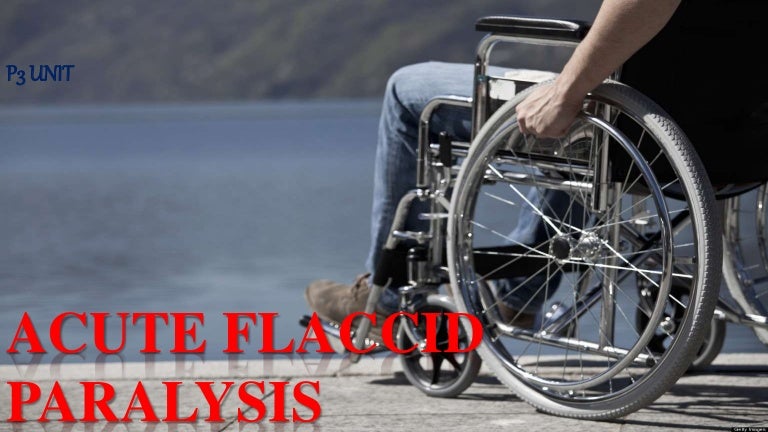 Flaccid Hemiplegia Flaccid Hemiplegia